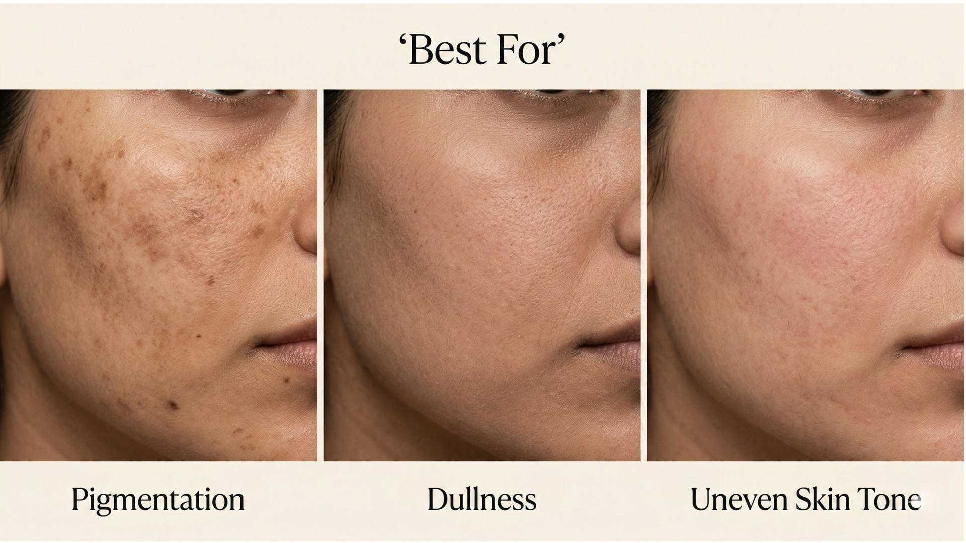Best Night Cream for Pigmentation